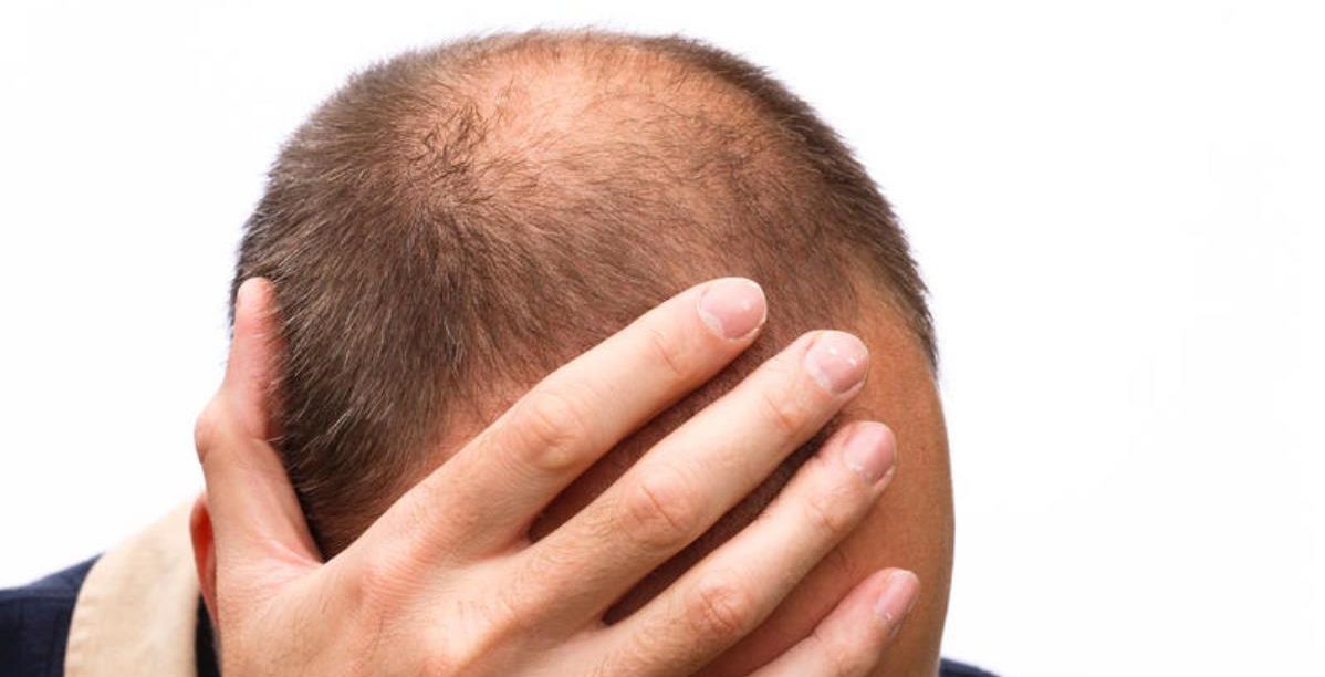 6 نصائح للحفاظ على الشعر الخفيف من الحد من تساقطه